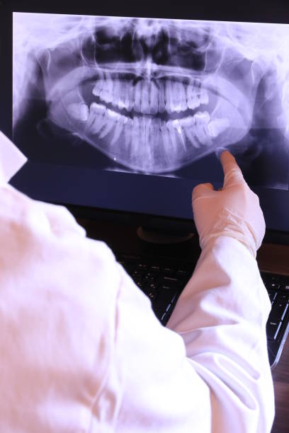 Best Emergency Wisdom Tooth Extraction in Mandeville, LA