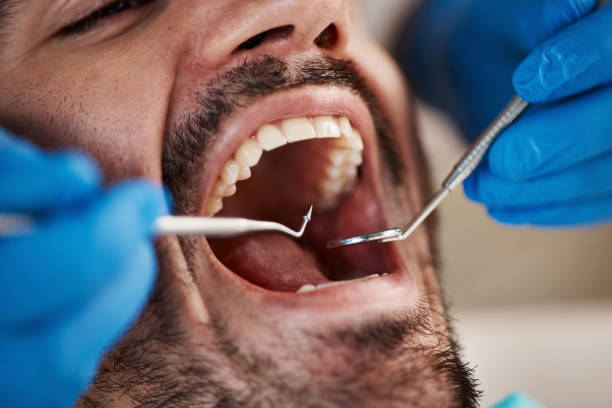 Best Emergency Cosmetic Dentistry (e.g., broken veneers) in Mandeville, LA